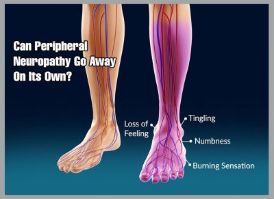 Does Neuropathy From Chemo Go Away? | Berkeley Institute International